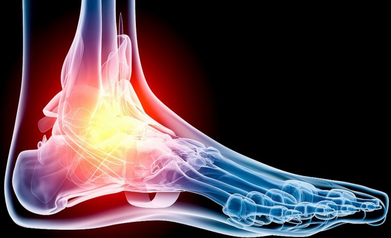 How Can I Stop Foot Pain?