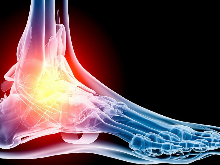 How Can I Stop Foot Pain?