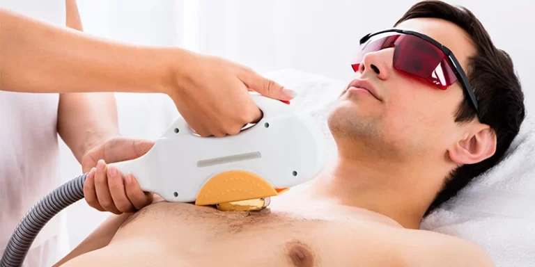 6 Best Ways to Remove Body Hair for Men