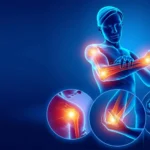 pain relief physiotherapy